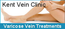 Varicose Vein Treatments at The Kent Vein Clinic